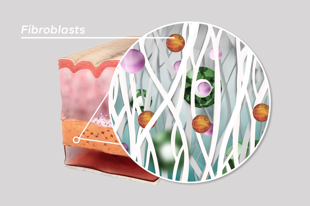  What is Sculptra - Image 5