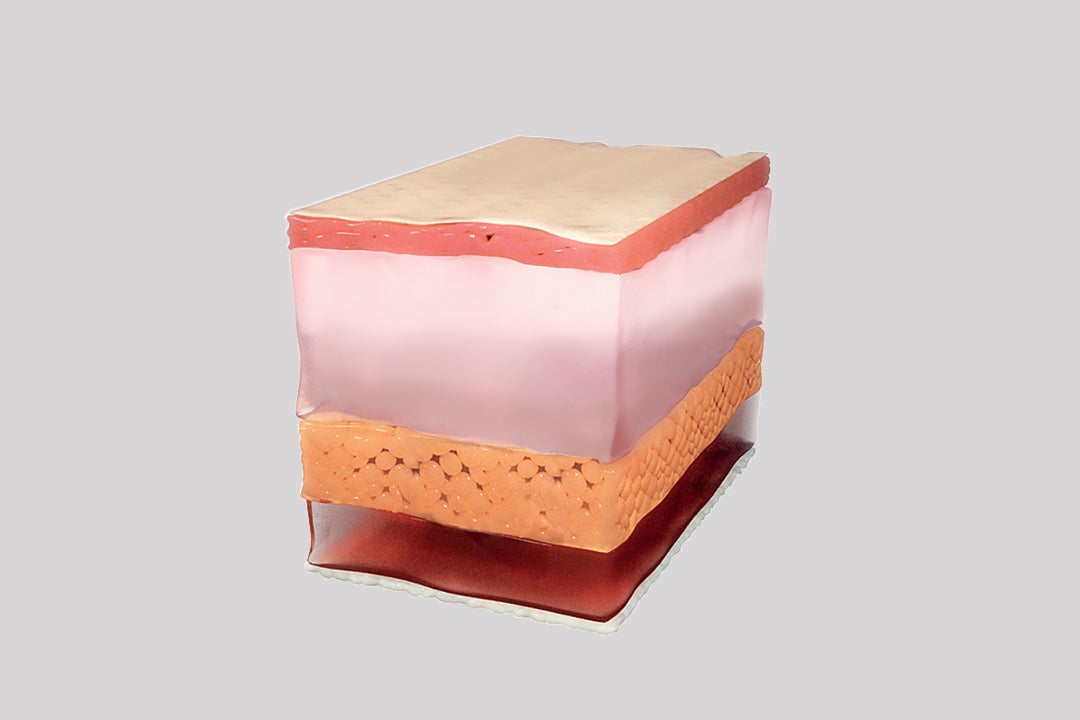  What is Sculptra - Image 6