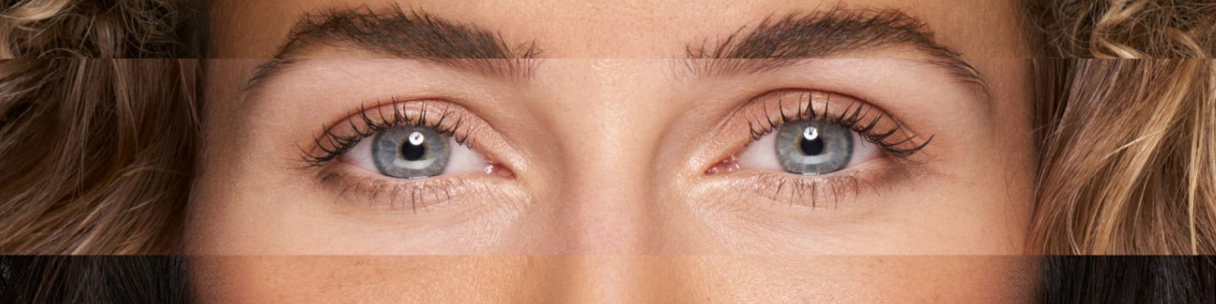 Dysport Banner-desktop